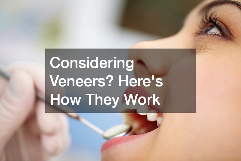 Considering Veneers? Heres How They Work