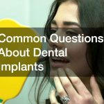 Common Questions About Dental Implants